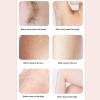 ZJchao Facial Hair Remover with LED Light, Portable Rechargeable Bikini Area Hair Trimmer for Women Face Lips Removal view 2