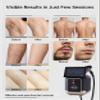 Effective Home Hair Removal Device For Clean view 3
