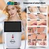 Dual Beauty Machine for Smooth and Glowing Skin view 3