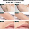Mini Portable Home Hair Removal Device, Fits Most Body Areas Skin Tones view 4