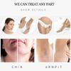 Soothing Cooling Hair Removal Device for Face, Armpit Legs, view 3