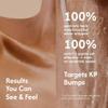 Ontu Body KP Exfoliating Sugar Scrub with 6% Urea, Vanilla Musk Scent, Body Scrub, Squeeze Bottle, 8 fl oz view 3