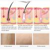 Portable 808nm/755nm/1064nm Hair removal Machine view 3