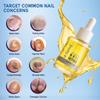 De-Fame:' Nail Care Serum with Vitamin E, Tea Tree, Lemon & Olive Oils, Nourishing Nail and Cuticle Serum for Daily Care, Shine Enhancing Formula, 1.01 fl oz (30 ml) view 3