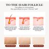808nm Ice Point Hair removal Machine For Whole Body Hair Reduction view 4