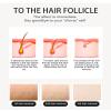 3 Waves 808nm Hair removal Machine For Whole Body Hair Reduction view 2