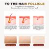 2&1 Professional Hair Removal Machine view 4