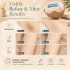 2PCS-Portable 3-Layer Hair Shaver with Rotating Cover, Razor for Women view 3