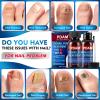 Toenail Care Extra Strength - 25% Undecylenic Acid - for Broken, Discolored Nail & Ingrown Toenail - 30ml view 2