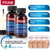 Toenail Care Extra Strength - 25% Undecylenic Acid - for Broken, Discolored Nail & Ingrown Toenail - 30ml view 4