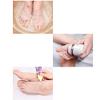 Electric for Feet Rechargeable Automatic Pedicure Peeling, Dead Skin Callus Grinding Artifact Foot Repairing Machine view 4