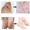 Electric Foot Grinder for Removing Dead Skin and Calluses Artifact Heel Rechargeable Tool Household Automatic Pedicure view 3