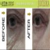 "LIFTIN Advanced" INSTANT FACE LIFT by Juiceika. This is an INCREDIBLE 60 Second FACE LIFT! view 2