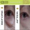 "LIFTIN Advanced" INSTANT FACE LIFT by Juiceika. This is an INCREDIBLE 60 Second FACE LIFT! view 3