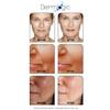 Anti Aging Resurfacing Peel Pads - Contains Salicylic, Glycolic, & Lactic for Face, Neck & Dcollet. Exfoliates, Brightens, Tones the Skin & Reduces Dark Spot, Fine Lines & Wrinkles for Radiant Glow. view 3