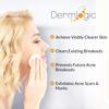 Acne Treatment Pads- Contains Salicylic, Glycolic, & Lactic Acid for Face & Body. Clears Away Clogged Pores, Oily Skin & Cystic Breakouts. Removes Dark Spots, Blackhead & Whitehead Pimples view 4