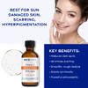 Medpeel 70% AHA & Vitamin C Brightening Essential Chemical Peel at Home Kit, Includes Peel, Prep, Neutralizer, Deep Strength Professional Grade Chemical Face Peel, Reduces Age Spots, 1oz/30ml view 4