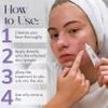 NXN Acne Edit Spot Treatment with Probiotics, Licorice Root, Ginger and Colloidal Sulfur, to rapidly reduce acne blemish size view 4