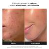 Paula's Choice SKIN PERFECTING 2% BHA Liquid Exfoliant, 1 Fl Oz view 3