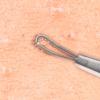 Beaute Galleria Double Loop Blackhead Remover Pimple Extractor Popper for Acne Comedone Blemish Whitehead Zit Removal Tool view 3