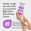 AmLactin Ultra Smoothing - Therapeutic Hand Cream for Dry Cracked Hands - No-Scrub Exfoliator and Moisturizer with 15% Lactic Acid AHA, 4.9 oz (Packaging May Vary) view 3