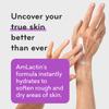 AmLactin Ultra Smoothing - Therapeutic Hand Cream for Dry Cracked Hands - No-Scrub Exfoliator and Moisturizer with 15% Lactic Acid AHA, 4.9 oz (Packaging May Vary) view 4
