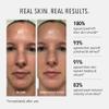 HydroPeptide Polish & Plump Face Peel Radiant Two-Step System, Boosts Firmness and Plumpness, 1 Set view 4