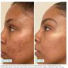 Urban Skin Rx Even Tone Cleansing Bar | 3-in-1 Multitasking Treatment Daily Cleanser, Exfoliator, & Mask | Targets Uneven Skin & Improves the Appearance of Dark Spots | Includes Applicator | 2.0 Oz view 4