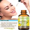 Botanical Beauty Organic EVENING PRIMROSE OIL 100% Pure Natural Undiluted Unrefined Virgin Cold Pressed Carrier Oil. 0.5 Fl.oz.- 15 ml for face, skin, hair, nails view 3
