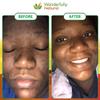 Wonderfully Natural #1 African Black Soap for Acne & Dark Spots | Organic Vegan Satisfaction Guarantee | 1lb bar 90 day Supply view 2