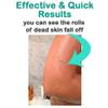 Elbahya Exfoliating Mitt Body Kessa Hammam - Body Tool Remover of Dead & Dry Skin or Keratosis Pilaris, Made of 100% Viscose Fiber (Gold Pack of 1) view 2