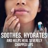 ChapStick Classic Medicated Lip Balm Tubes, Chapped Lips Treatment and Skin Protectant - 0.15 Oz (Pack of 2) view 2