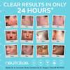 Neutralyze Exfoliating Acne Treatment Wipes - Maximum Strength, Textured Acne Pads with 2% Mandelic Acid & 2% Salicylic Acid for Face & Body - Suitable for All Skin Types, Teens & Adults (100 Wipes) view 4