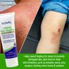 TriDerma Intense Fast Skin Healing Cream for Hard-to-Heal Skin Irritations, Sores, Rashes, Dry, Cracked Hands, Cuts, Chafing, Burns, Scrapes - First Aid Kit Essential - FSA Eligible - 4.0 oz Tube view 2