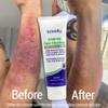 TriDerma Intense Fast Skin Healing Cream for Hard-to-Heal Skin Irritations, Sores, Rashes, Dry, Cracked Hands, Cuts, Chafing, Burns, Scrapes - First Aid Kit Essential - FSA Eligible - 4.0 oz Tube view 3