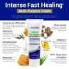 TriDerma Intense Fast Skin Healing Cream for Hard-to-Heal Skin Irritations, Sores, Rashes, Dry, Cracked Hands, Cuts, Chafing, Burns, Scrapes - First Aid Kit Essential - FSA Eligible - 4.0 oz Tube view 4