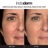 Anti-Aging Resurfacing Pads  Smooths Fine Lines, Wrinkles, Dark Spots & Skin Roughness to Enhance the Skins Texture & Tone for Radiant Glow. view 4