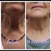 Fleur De Vie Cosmetics NEW and IMPROVED Help I've Fallen Firming Neck Treatment- view 2