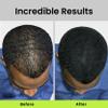 ECLIPSE Hair Fibers Grey for Thinning Hair for Women & Men to Conceal Hair Loss in 15 Seconds - 100% Undetectable Hair Building Fibers, 15g view 4