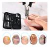 Bcabo 10Pcs/set Ingrown Toenail Tools Kit, Nail Treatment Foot Tool,Ingrown Toenail Removal Correction Clippers, Surgery Grade Nail File Lifter, Professional Pedicure Tool view 3