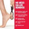 Revlon Callus Remover, Foot File with No-Mess Cover, Gently Exfoliates and Smooths Feet, Softens Calloused Areas, Stocking Stuffer for Women, 1 count view 3