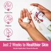 FOOTLOGIX Peeling Skin Formula with Spiraleen, 4.23 oz view 4