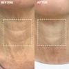 Wrinkles Schminkles Neck Wrinkle Patch - Reusable Silicone Smoothing Pads, Sensitively Formulated Wrinkle Patches. Reduce Wrinkles - Innovative Wrinkle Treatment - Targeting Neck Wrinkles (1 Pack) view 3