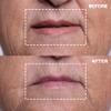 Wrinkles Schminkles Mouth & Lip Wrinkle Patch - Reusable Silicone Smoothing Pads for Noticeable Wrinkle Reduction - Lip Wrinkle Prevention for Youthful, Smooth Skin (2 Pack) view 3