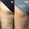 MALYS Cosmetics B-TIGHT Leave-On Cellulite Mask - Helps Reduce The Appearance Of Cellulite - Visibly Firms The Skin In The Butt Area view 3