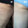 MALYS Cosmetics B-TIGHT Leave-On Cellulite Mask - Helps Reduce The Appearance Of Cellulite - Visibly Firms The Skin In The Butt Area view 4