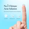 DERMAKR Discreet Acne Pimple Patch | Spot Cover Treatment Solution Cystic Acne Pimple Scars | Hydrocolloid Facial Stickers | Waterproof Patches Quick Healing Pimples view 2