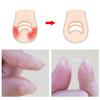 Ingrown Toenail Corrector Strips Brace 10pcs/bottle Straightener Clip Curved BS Brace Toenails Thick Correction Foot Tool view 3