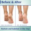 Pedifix Podiatrists' Choice 20% Urea Callus Control Extra Strength Foot Cream 4 Oz. (113g) - Professional Treatment for Dry, Cracked Feet, Callus & Foot Care Relief view 2
