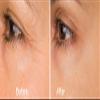 Anti Aging-Argireline Copper Peptide Serum Booster w/Snap-8, Matrixyl 3000 Rejuvenate Revealing Youthful Looking Skin view 4
